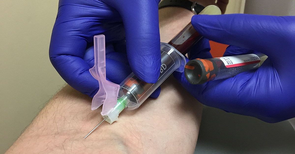 needle inserted into vein to take blood.
